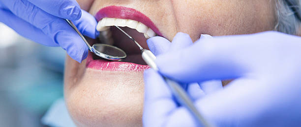 Best Emergency Wisdom Tooth Extraction in Alvin, TX
